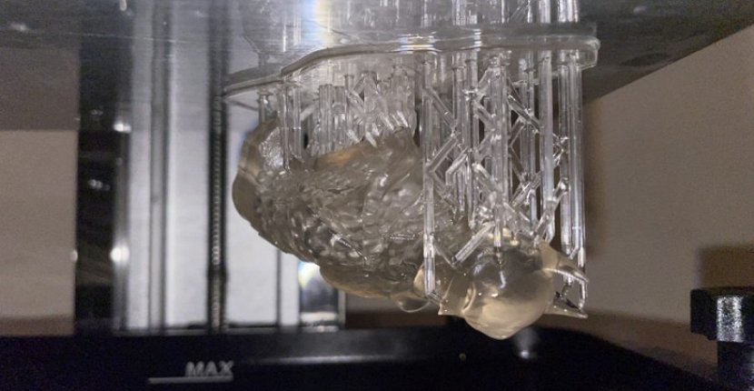 В России создали полимер для 3D-печати биоразлагаемых имплантатов